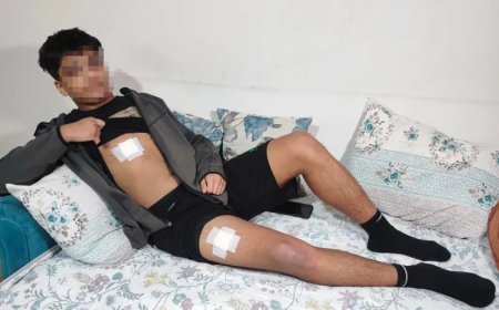 Akran zorbalığı can alıyordu. 15 yaşındaki çocuk yaşıtı tarafından üç yerinden bıçaklandı