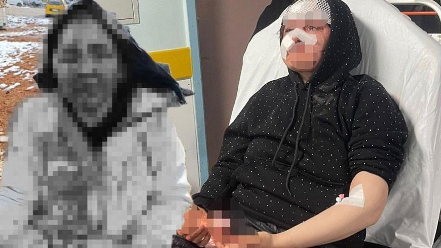 Karısını taşla komaya soktu! Boşanmak isteyen eşine dehşeti yaşattı: 'Kucağında çocuğuyla vuruyor'