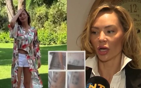 Şişli'de estetik yaptırmak isteyen mankenin vücudu yandı. Dizilerde oynuyordu, işinden oldu