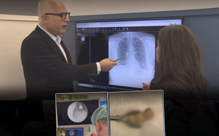 Sabah uyandığında dişleri yoktu! Röntgende gerçek ortaya çıktı