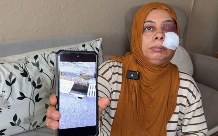 Elektrikli bisikletiyle rögara düştü! Dişleri kırıldı, yüzüne 14 dikiş atıldı