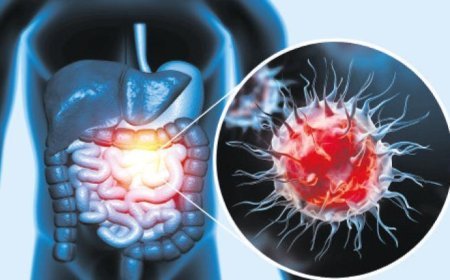 50 yaş altı kolon kanseri alarmı!