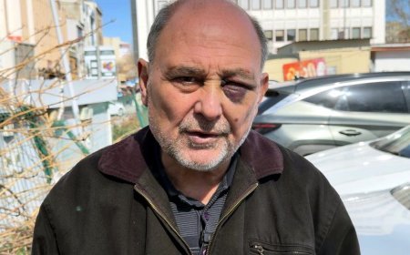 Annesinin cenazesinden dönüşte darbedildi: Çift görüyorum, iyi değilim, şikayetçiyim