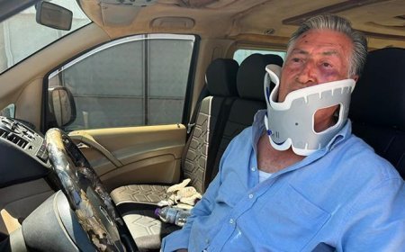 Antalya'da Litvanyalı boksör tur şoförünü hastanelik etti: 'Telefonu şarja koymadın diye yumrukladı'