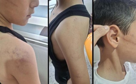Manisa'da vicdanları sızlatan olay! Öz babadan evladına şiddet; çocuk koruma altına alındı