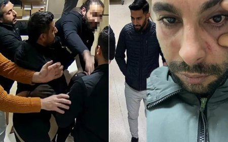 Rapor isteyen hastaya yumruk attı yüzde 30 görme kaybına neden oldu. Doktora 2,5 yıla kadar hapis istemi