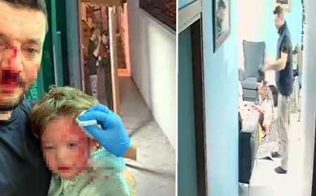 Baba ve 14 aylık kızına saldırı davası. Tutuklu sanık tahliye edildi