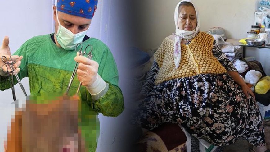 Karnından çıktı, doktorlar gözlerine inanamadı!