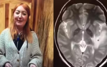 Hindistan gezisi sonrası kabusu yaşadı! Beyninde 38 adet tespit edildi