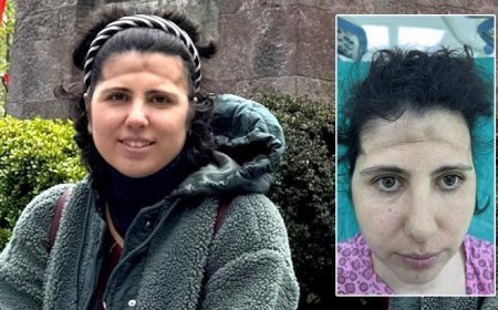 3 boyutlu teknoloji mucizesi! Alnındaki çöküklük tarih oldu