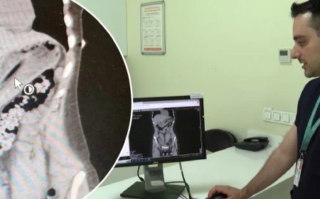 Zayıflamak isterken diş fırçası yuttu!