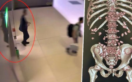 İstanbul Havalimanı'nda yürümekte zorlanan yolcu polisi alarma geçirdi. Gerçek hastanede ortaya çıktı