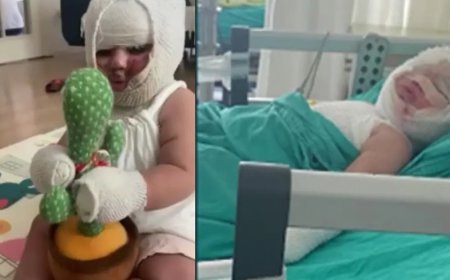 Domates konservesi bomba gibi patladı, 9 aylık bebeğin vücudu yandı