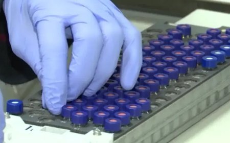 Keçiören Belediyesi'nde uyuşturucu testi yapıldı: 171 kişi pozitif çıktı