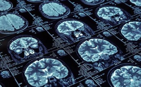 45 yaş üstü dikkat! Ezber bozan araştırma: '3 basit alışkanlık demansı 13 yıl geciktirebilir'