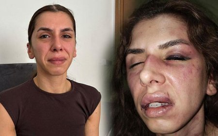 Eşi tarafından 4 saat işkence gördü, boğazına bıçak dayandı: Öldüm sandım ama bayılmışım
