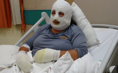 Ardahan'da yangın dehşeti: 6 yaşındaki kızını alevlerin arasından böyle kurtardı