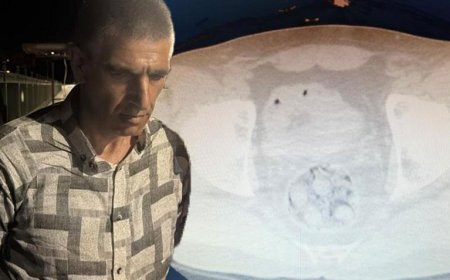Midesindeki uyuşturucu kapsülleri patladı! Hastanede can verdi