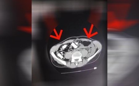 Hepsi mide ve bağırsaklarından çıktı! Tutuklanarak cezaevine gönderildi