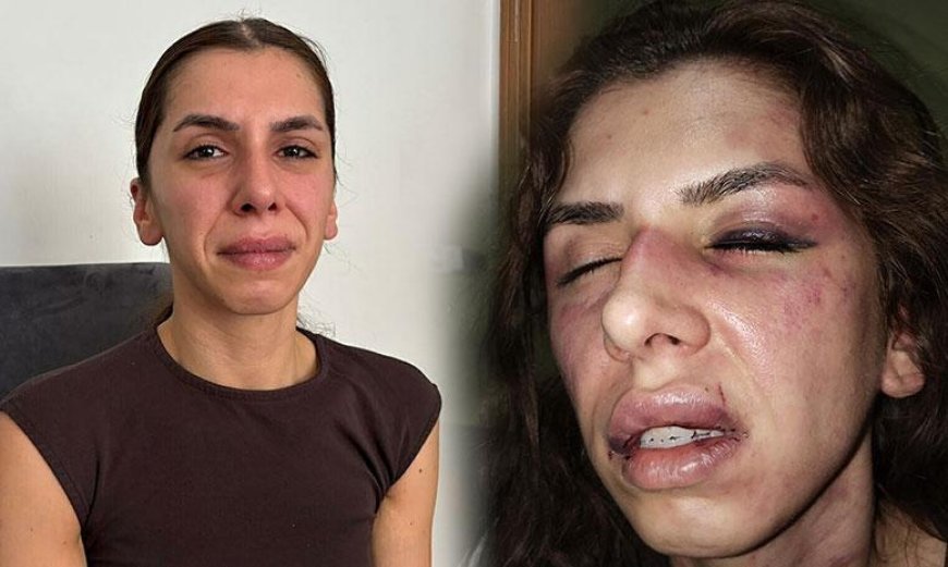Eşi tarafından 4 saat işkence gördü, boğazına bıçak dayandı: Öldüm sandım ama bayılmışım