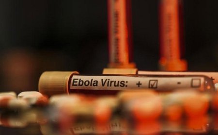 Nijerya'da ilk Ebola virüsü vakası tespit edildi