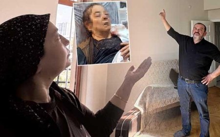 Televizyon izliyordu, gözünü kaybetti: Bunu yapan insan nasıl yapmış?