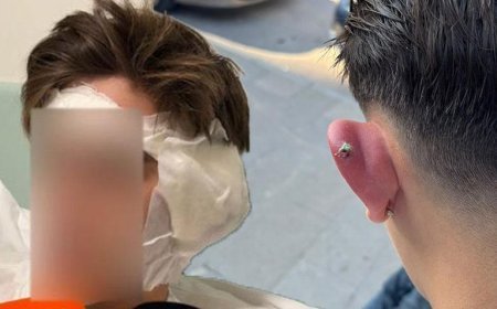 Kulağına piercing taktırdı, hayatı kabusa döndü! 5 gecedir hastanede